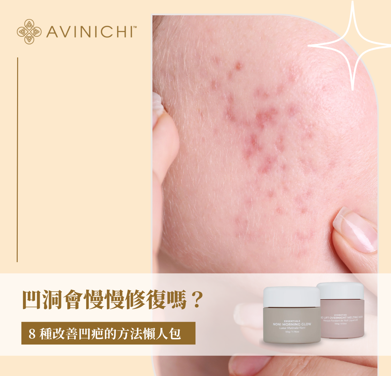 凹洞會慢慢修復嗎？8 種改善凹疤的方法懶人包
