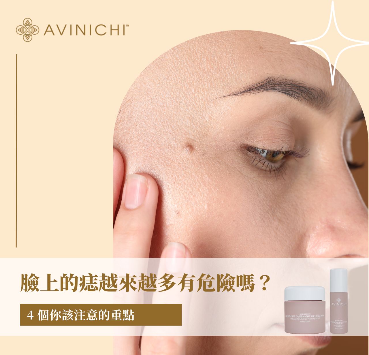 臉上的痣越來越多有危險嗎？4 個你該注意的重點