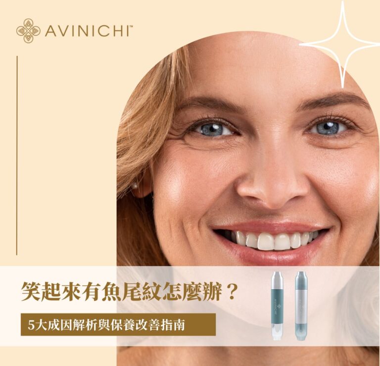 笑起來有魚尾紋怎麼辦？5大成因解析與保養改善指南