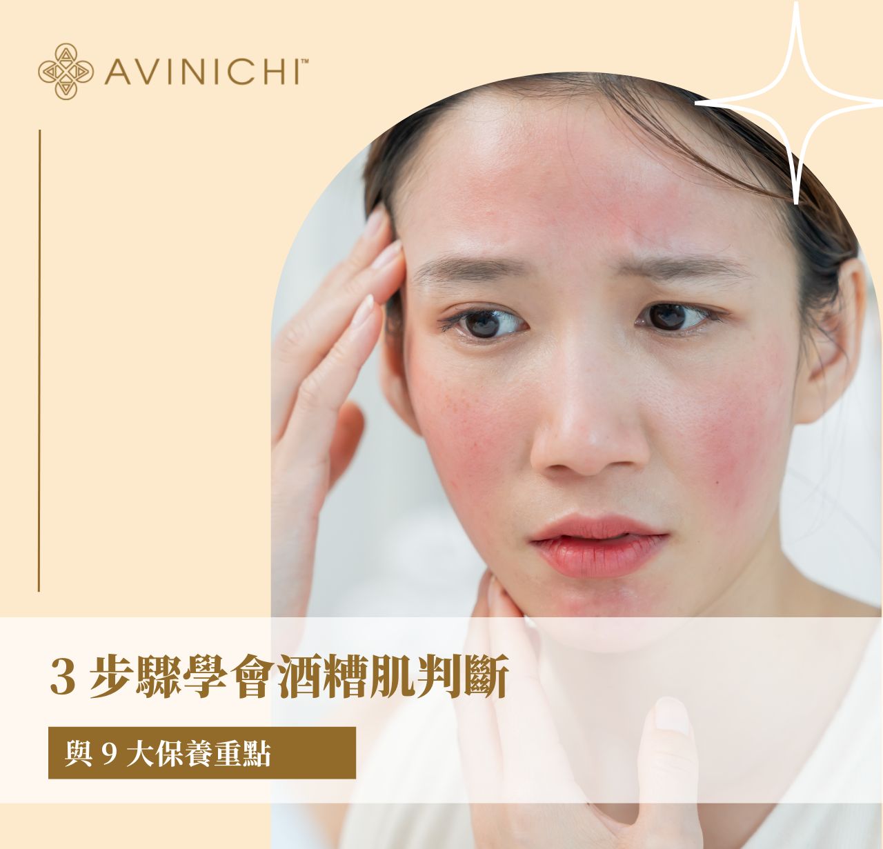 3 步驟學會酒糟肌判斷，與 9 大保養重點