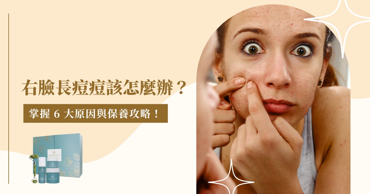 右臉長痘痘該怎麼辦？掌握 6 大原因與保養攻略！