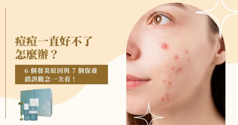 痘痘一直好不了怎麼辦？6 個發炎原因與 7 個保養錯誤觀念一次看！