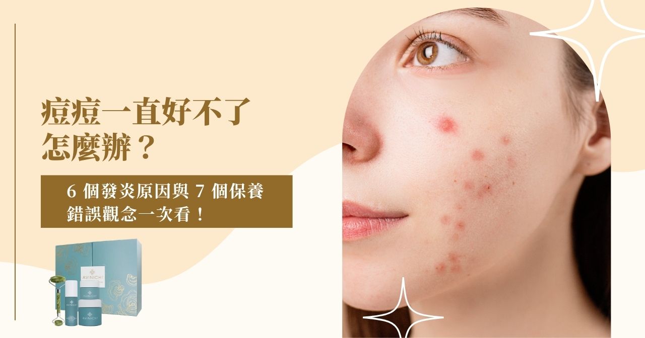 痘痘一直好不了怎麼辦？6 個發炎原因與 7 個保養錯誤觀念一次看！