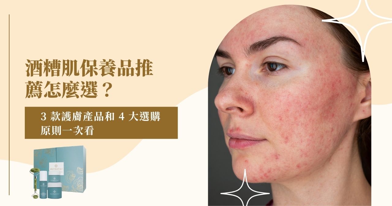 酒糟肌保養品推薦怎麼選？3 款護膚產品和 4 大選購原則一次看